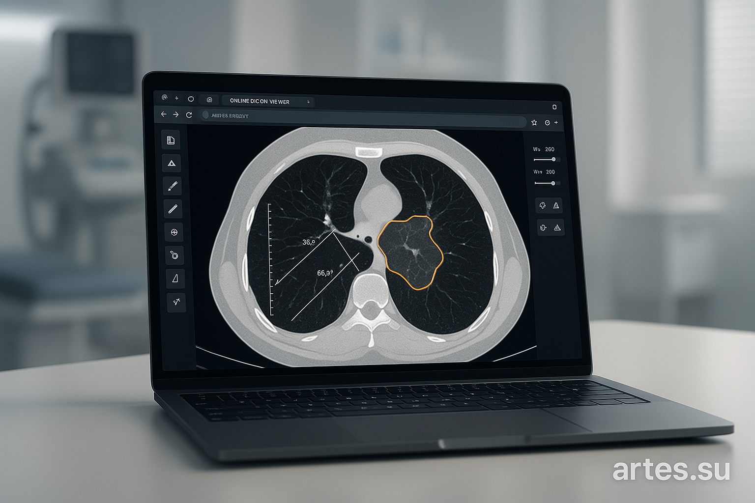 DICOM-вьюер онлайн: как анализировать медицинские снимки без установки программ
